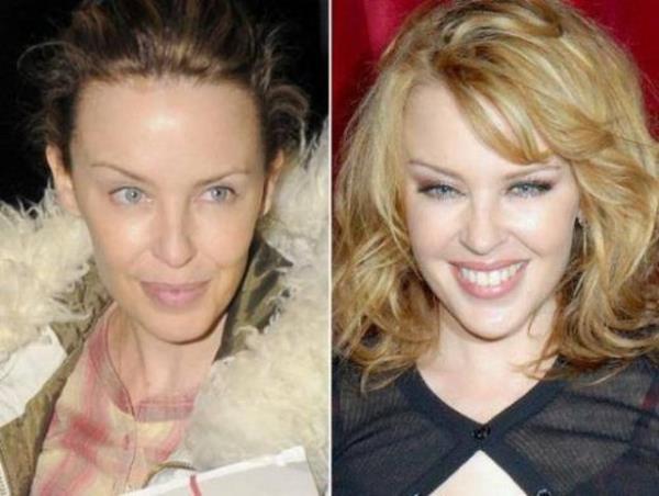 Kylie Minogue