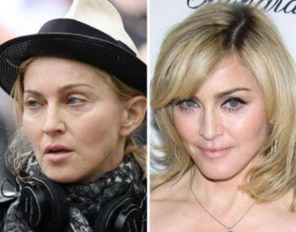 MADONNA