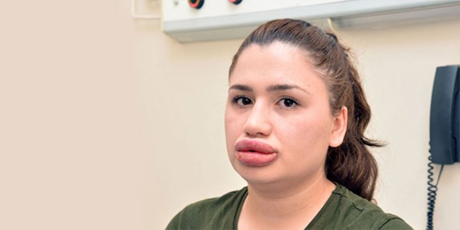 Silikon mağduru hemşirenin son haline bakın!
