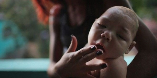 Zika virüsü Türkiye'de