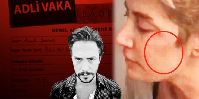 Sıla'nın darp raporu ortaya çıktı: Korkunç detaylar