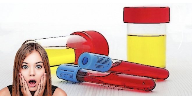Hangi idrar rengi hangi hastalığın habercisidir?