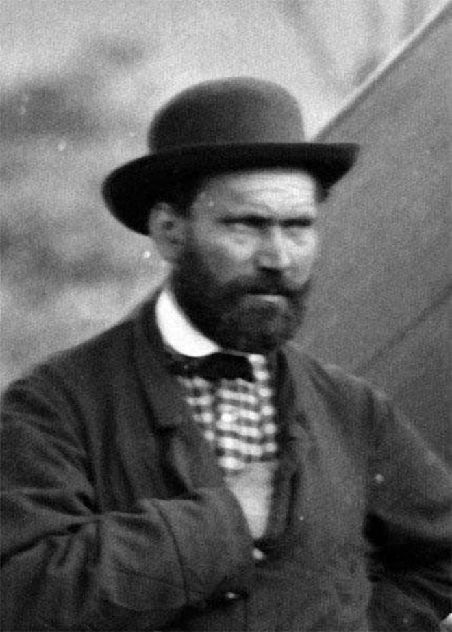 Allan Pinkerton, 1884 yılında bir kaldırımda yürürken kayarak dilini ısırmıştı. Bu talihsiz ısırık daha sonra enfeksiyona dönüştü ve Pinkerton'ın hayatına maloldu.
