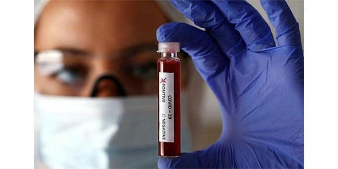 Testleri negatif çıkanlarla ilgili ürtüken iddia!