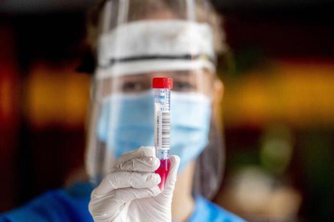 CDC'nin yaptığı yeni açıklamyla birlikte koronavirüsün belirtileri 11'e yükselmiş oldu. Şimdiye kadar açıklanmış yaygın belirtiler şunlardı: