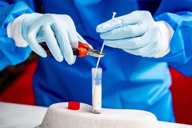 BAŞ AĞRISI - KAS AĞRISI<br>TAT VE KOKU KAYBI