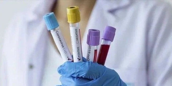 Koronavirüs vaka sayısı 26 milyonu aştı
