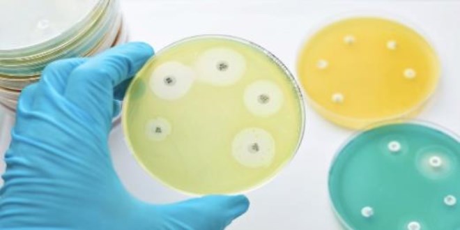 Bilim insanlarından uyarı: Antibiyotik dünyadaki bir numaralı ölüm nedeni