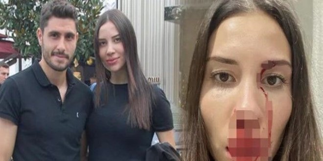 Futbolcu Özer Hurmacı ile eşine 1,5 yıla kadar hapis talebi