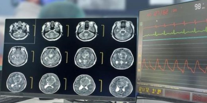 Beyin kanserine karşı implant