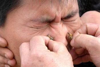 Çin'de arı zehrinin romatizmaya iyi geldiğine inanılıyor.