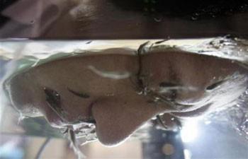 Japonya'da cilt tedavisi olarak akvaryuma yüzlerini daldırıyorlar.