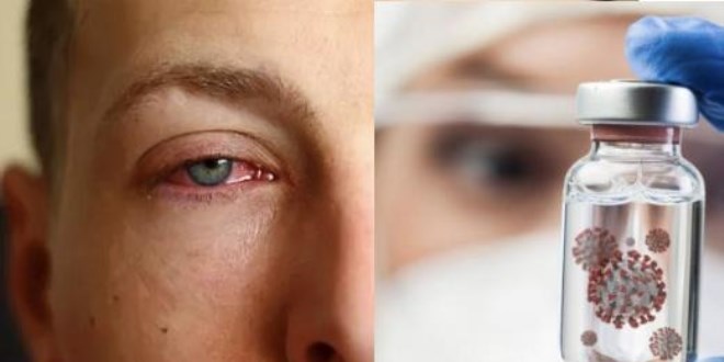 Vakalar patladı! Bu virüs görme kaybına neden oluyor