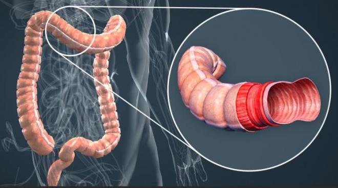 Kalp ve iç hastalıkları profesörü, Canan Karatay sağlıklı yaşam hakkında önerilerde bulundu. Bağırsak sağlığına vurgu yapan ve "İkinci beyin" olarak tanımladığı bağırsakların sağlığın temeli olduğunu vurguladı. Peki Bağırsak tembelliği tehlikeli midir? İşte Canan Karatay'ın tembel bağırsağı coşturduğu o tarif...