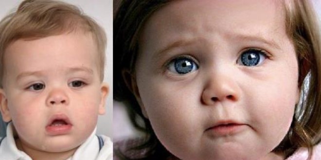 Çocuklarda vitamin eksikliği nasıl anlaşılır?
