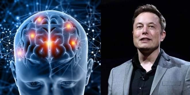 Neuralink onay aldı: Beynine çip taktırmak isteyen insanlar aranıyor!