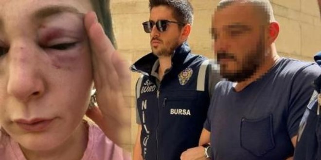 Eski sevgiliye 9 kafa darbesine 5 yıl 2 ay hapis