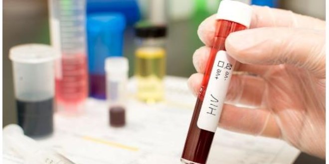 Türkiye'de HIV artış eğiliminde: Gizli pandemi gibi!