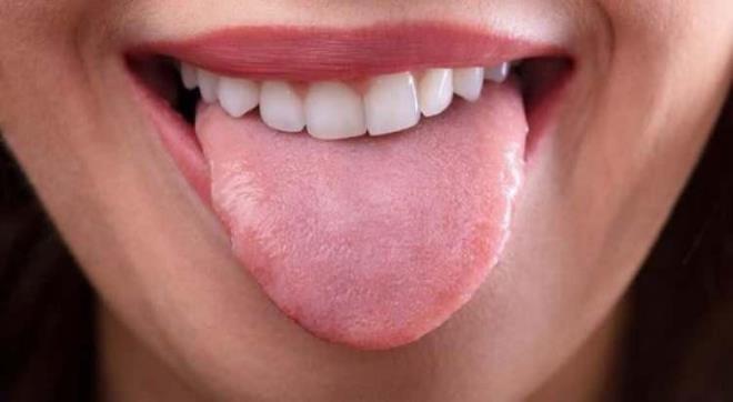 Eğer dilde çilek benzeri bir görüntü oluştuysa, bu durum, kızıl hastalığı veya Kawasaki hastalığı gibi ciddi sağlık sorunlarına işaret edebilir. Ayrıca, ateşli hastalıklar ve alerjik reaksiyonlar da dilin kızarmasına neden olabilir.