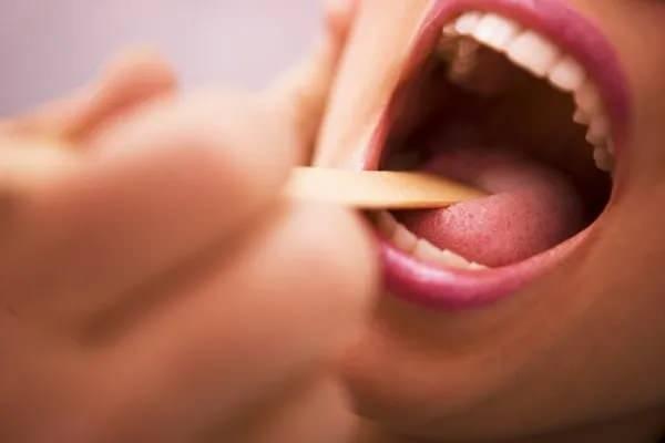 5. Siyah veya Kahverengi Dil  <br>  Siyah veya kahverengi dil genellikle sigara kullanımı, aşırı çay veya kahve tüketimi gibi nedenlerle ortaya çıkar.