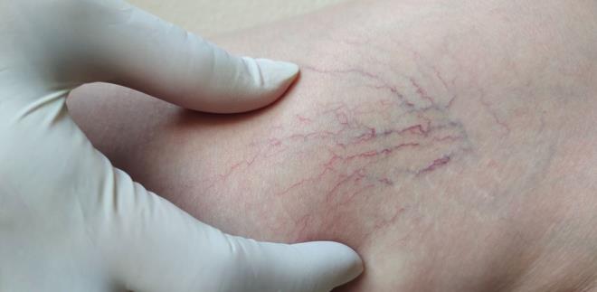 Medical News Today tarafından bildirildiği üzere, araştırma sonucunda uzun süre ayakta durmanın, derin ven trombozu yani halk arasında toplardamarda pıhtı oluşması ve varisli damarlar da dahil olmak üzere dolaşım sorunları riskini artırabileceği tespit edildi.    Araştırmacılar ayrıca günde 10 saatten fazla oturmanın bireyin hem kardiyovasküler hastalık hem de ortostatik dolaşım hastalığı riskini artırabileceğini açıkladı.