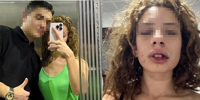 Bayıltana kadar dövüp arkadaşına telefon açtı: Mezar hazırlar mısın?