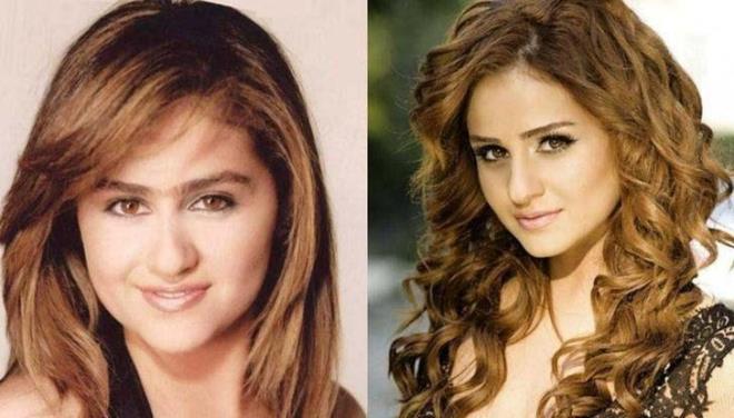 Ünlü şarkıcı, geçtiğimiz haftalarda yaptırdığı estetik operasyonlarla ilgili sessizliğini bozdu. Değişimi eleştiri oklarının hedefi haline gelen Zeynalova, şöyle konuştu:    "Kendime bakıyorum, bir kadının zaten kendisine bakması gerekiyor. Büyüdüm herhalde ya. Burnum ve üst dudağım dışında estetiğim yok. Buna inanmıyorlar ama umurumda değil.