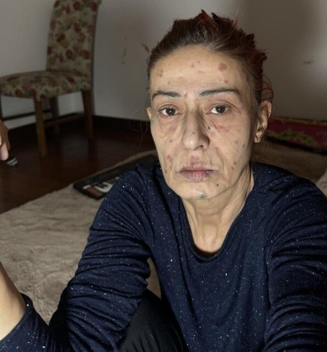 "AZ YİYORUM"<p>    Öte yandan geçtiğimiz haftalarda  takipçilerinin sorularını yanıtlayan ünlü isim, "Nasıl öyle fit kalmayı başarıyorsun Yıldız abla" diyen takipçisine ise "Az yiyorum" şeklinde yanıt vermişti.