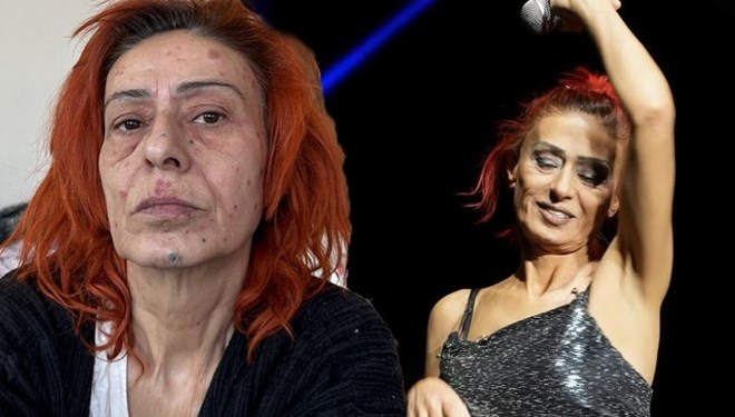 Delikanlım, Hastayım Sana, Haberi Olsun, Çabuk Olalım Aşkım gibi şarkılarıyla tanınan Yıldız Tilbe, saçını boyadıktan sonra talihsiz bir olay yaşadı. Yüzünde yanıklar oluşan şarkıcı, son halini sosyal medya hesabından paylaştı.<p>    "BİR DAHA SAÇIMA BOYA SÜRMEYECEĞİM"  <br>  Ünlü şarkıcı yüzündeki yanıkların net bir şekilde göründüğü fotoğraflarını takipçileriyle paylaşarak "Bir daha saçıma boya sürmeyeceğim. Kimyasal yanık oldum" ifadelerini kullandı.