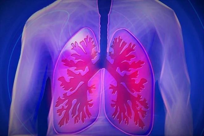 Çalışmada, ?uzaysal metabolomik? adı verilen ileri düzey bir analiz yöntemi kullanıldı. Bu teknik, araştırmacılara doku içerisindeki küçük moleküllerin konumlarını yüksek hassasiyetle inceleme imkanı sunuyor.