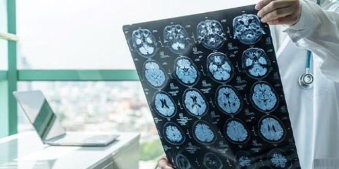 Alzheimer'a neden olan alışkanlık