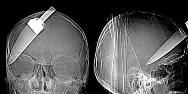 Akıl almaz X-Ray görüntüleri!