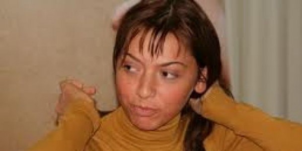 Ünlülerin estetiksiz halleri