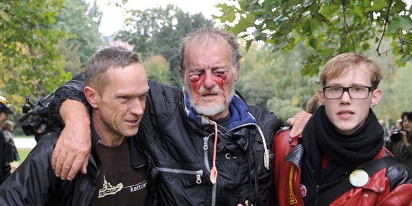Alman polisi eylemcilerin gözlerini oydu