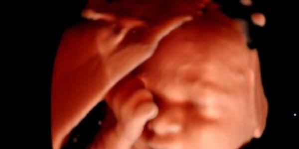 Bebeğin anne karnında fotoromanı