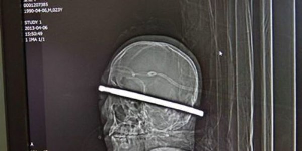 Şaşırtan x-ray fotoğrafları