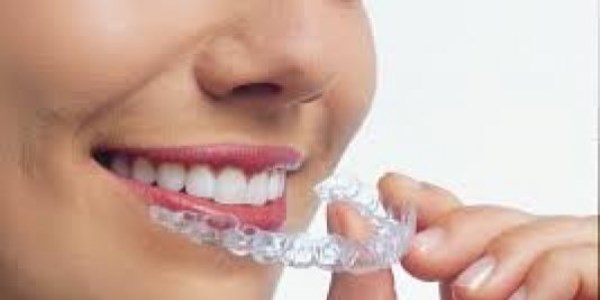 Çarpık ve bozuk yapılı dişlere şeffaf çözüm