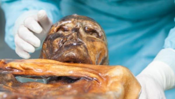 tzi'nin lmne omzuna saplanan bir okun neden olduu, lmnden ksa sre nce kei eti yedii belirlendi. Dilerinin rk olduu ve kenelerin srmasyla bulaan lyme hastalna yakalanm olduu tespit edildi. Vcudunun eitli yerlerinde dvme bulunan tzi'nin sa ve gz renginin kahverengi olduunu, kan grubunun ise 0 (sfr) olduu ortaya karld.