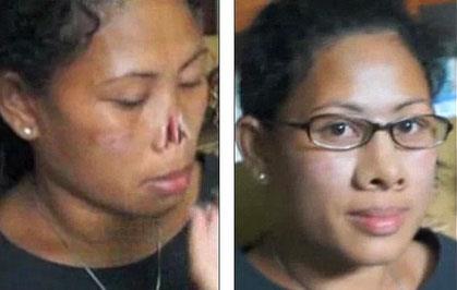 Oscar dll zel efekt ve makyaj uzman Alec Gillis, kocas tarafndan burnu kesilen kadna yeni bir burun yapnca..