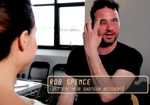 Kanadal gazeteci kamera yerletirilen gznn, normal gzden farksz olabilmesi iin aba gsteriyor.