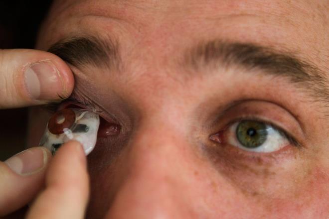 Dokuz yanda gerekleen talihsiz olay sonucunda tek gznden olan gazeteci ve rejisr Rob Spence, kaybettii gznn yerine kamera yerletirme fiktrini gerekletirmek iin oz uzun zamandr bekliyor.