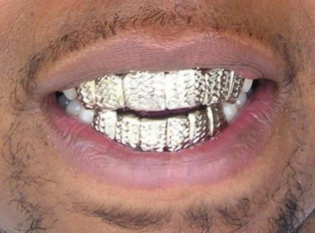 4- Platinyum 1 gram: 58 dolar Platin bilimsel deneylerde katalizr olarak kullanlrken ayn zamanda tak malzemesi de olabilir. Bunun dnda kanser tedavisinde kullanlan ilalarda da bu maddeye rastlayabiliriz.