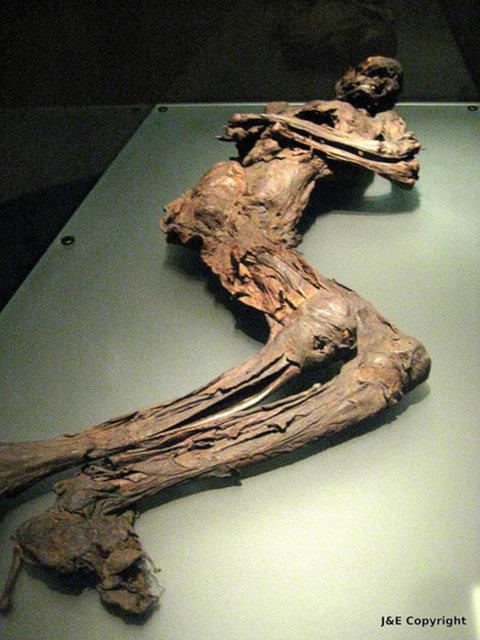 Bu kiinin cesedinin neden rmediini inceleyeceiz.