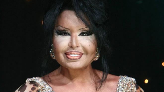 Blent Ersoy: Blent Erko