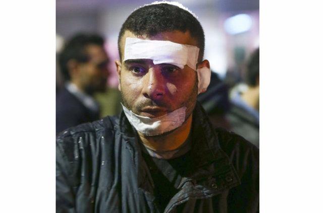 "HERKES BENM KADAR ANSLI DELD"    <br>ansl olduunu ve kk yaralarla olay atlattn dile getiren Ak, "ene ve alnma demir girdi. Onu karttlar. Kulakta biraz yara var. Onlarn tedavisini yaptlar. Ben kurtuldum ama herkes benim kadar ansl deildi" diye konutu. Patlamada yaralanan 26 yandaki Murat Ak'n da, Dkap Eitim ve Aratrma Hastanesi'nden ayakta tedavi sonrasnda taburcu edildii renildi.