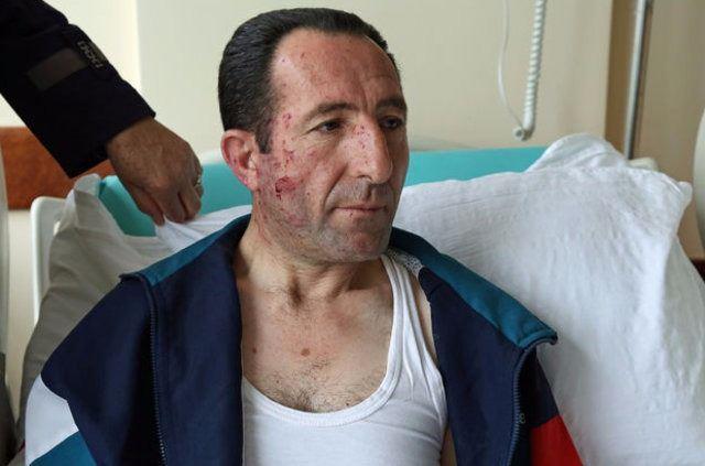 "PATLAMA HAREKET HALNDEYKEN OLDU"  <br>  Kulland Esertepe-Kzlay-Bakanlklar seferini yapan 284 numaral otobste 10'un zerinde yolcu bulunduunu anlatan Ylmaz, unlar kaydetti: "Saat 18.40'ta Zafer ars karsndaki duraktan yolcu aldm. Kzlay'daki trafik lambas yeil yanyordu. Snmesine 50 saniye vard. Ben orta eritten seyrediyordum. Yaklak 30 kilometre sratim vard. Sol erit botu. Sa eritte bir taksi ile halk otobs vard. Iklar getikten 50 metre sonra kendimizi bir alev topunun ierisinde bulduk."