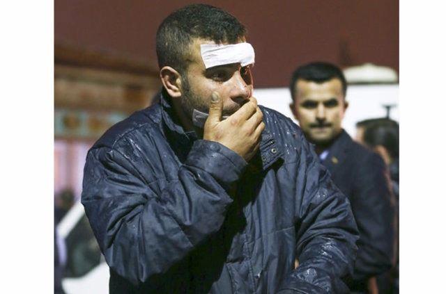 "BENM BULUNDUUM YERDE 30-40 K VARDI"  <br>  Saldrnn ardndan Ankara Numune Eitim ve Aratrma Hastanesi'ne getirilerek tedavisi yaplan yarallardan 28 yandaki Doan Ak, yapt aklamada, patlamann Gvenpark'taki evik kuvvet ekiplerinin olduu yerde gerekletiini syledi. Ak, "Herkes otobs bekliyordu. Benim bulunduum yerde 30-40 kii vard" dedi.