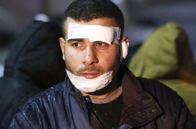 TERR K KARDE DURAKTA YAKALADI  <br>  Bakentte akam saatlerinde yaanan terr saldrsnda yaralanan Doan ve Murat Ak kardeler, terrn kirli yzyle i knda tant. ki karde saldry hafif yaral olarak atlatt.