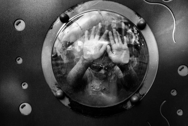 8 yandaki Amerikal Alex Gentile, dnyada bugne kadar sadece 9 kiide grlen XLPDR sendromundan mstarip.