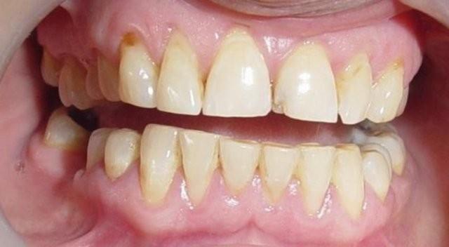 FDA yetkilileri, yaplan aratrmalar sonunda Triclosan'n kullanm konusunda herhangi bir deiiklie gidilmesi iin gerekli delilerin olmad aklamasnda bulundu.